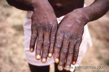 Monkeypox spread already an emergency, say African officials - Ealing Times