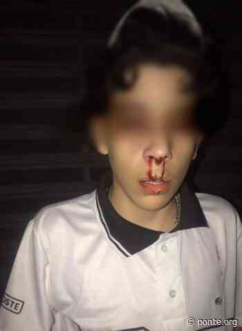 Segurança de shopping quebra nariz de menino de 14 anos por escada rolante desligada - Ponte Jornalismo