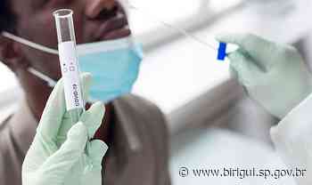 Secretaria de Saúde de Birigui define novos pontos de referência para testagem rápida para covid-19 - birigui.sp.gov.br