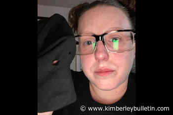 VIDEO: BC woman rescued from coyote attack searches for Good Samaritans – Kimberley Daily Bulletin - Kimberley Bulletin