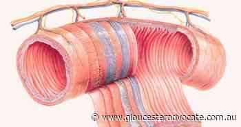 Gut bacteria breakthrough for IBD patients - Gloucester Advocate