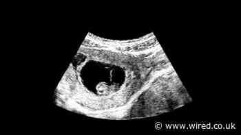 Genetic Screening Now Lets Parents Pick the Healthiest Embryos