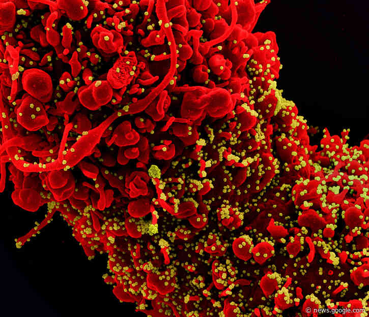 COVID-19 was third leading cause of death in the United States in both 2020 and 2021 - National Institutes of Health (.gov)