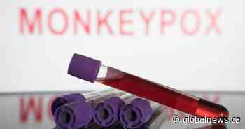 Ontario’s confirmed Monkeypox cases hits 101