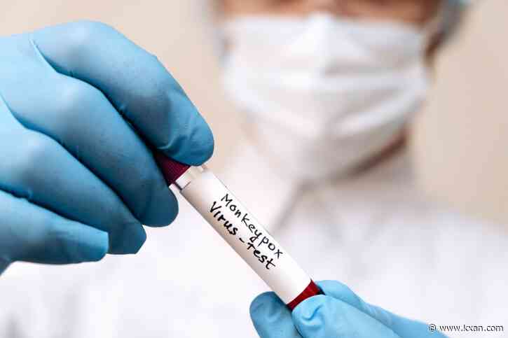 LIVE: CDC: Texas monkeypox case count climbs to 20