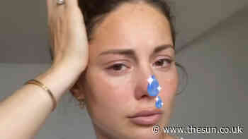 Louise Thompson fears she has ‘brain damage’ after hospital dash and nearly dying... - The Sun