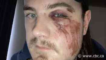 Quebec tourist waited a week for emergency surgery after B.C. doctor refused to operate over billing