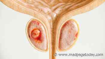 Novel Focal Therapy Yields Low Rate of Serious Prostate Cancers
