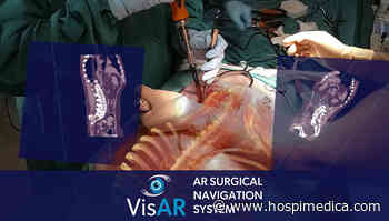 First Fully Immersive 3D Augmented Reality Surgical Navigation System for Precision Spine Surgery - HospiMedica