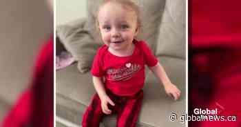 Toddler in pediatric intensive care unit in Edmonton after inhaling hot candle wax