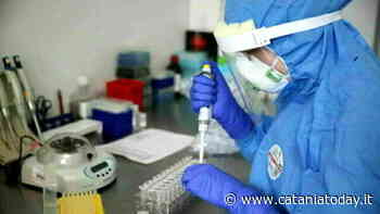 Policlinico-San Marco, primo caso di vaiolo delle scimmie a Catania - CataniaToday