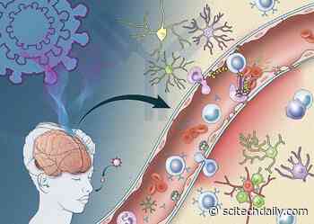 Revealed: How Immune Response Triggered by COVID-19 May Damage the Brain
