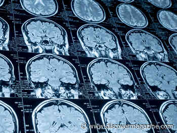 Scientists Reveal Which Brain Regions Regulate Movement