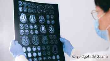 Drugs Used for Treating ADHD Could Help Treat Alzheimer’s Symptoms