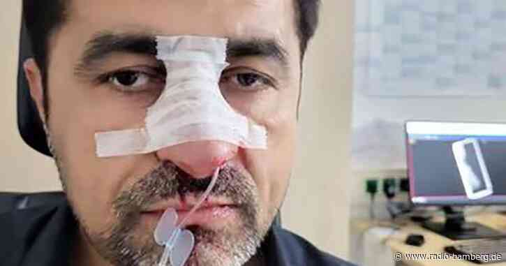 Nach Attacke auf Bayreuther Stadtrat – Tatverdächtiger gefasst