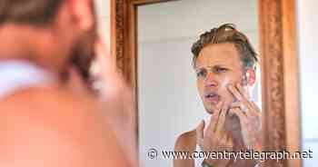 Skin A&E looking for Coventry and Warwickshire people for new series - Coventry Live