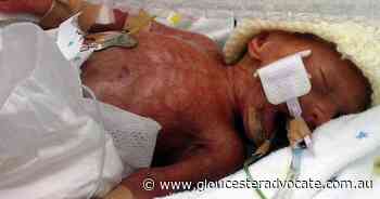 Skin-to-skin care good for babies and dads - Gloucester Advocate