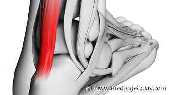 Trial Backs Steroid Shots for Stubborn Achilles Tendon Pain
