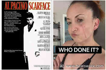 Impressive Cat Scratch Leaves Woman Looking Like Al Pacino in 'Scarface' - Newsweek
