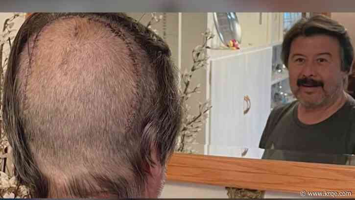 UNM neurosurgeon removes large brain tumor from state senator