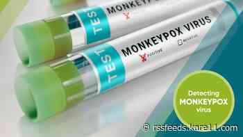 Monkeypox testing in Minnesota begins Monday amid increasing case numbers