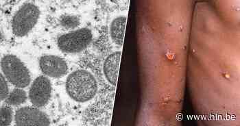 64 gevallen van apenpokken vastgesteld in Brussel | Brussel | hln.be - Het Laatste Nieuws
