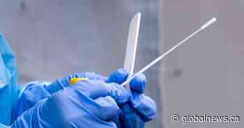 A doctor referral will soon be needed by some Albertans seeking PCR testing, province says