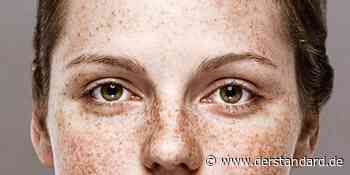 Sommersprossen: Vom Makel zum Ideal - Mode & Kosmetik - DER STANDARD