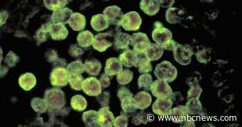 Brain-eating amoeba that infected a swimmer in Iowa is increasingly found in northern states
