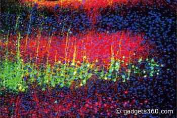 New Study Unravels How Sound Helps Relieve Pain in Mice