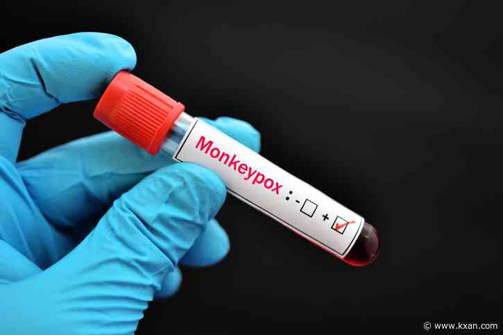 APH confirms 6 cases of monkeypox in Travis County, community spread of virus