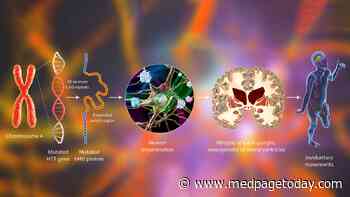 Clinical Challenges: New Hope for Huntington's Disease Chorea