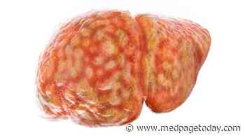 NAFLD Tied to Higher Dementia Risk