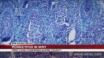 First confirmed case of Monkeypox in Erie County