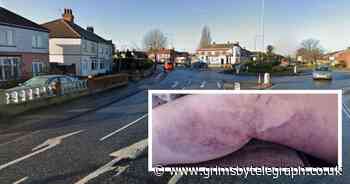 Pain of Grimsby mum knocked down as she crossed road with kids - Grimsby Live