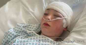 Girl 'dropped on her head' at school suffers serious brain injury - Grimsby Live