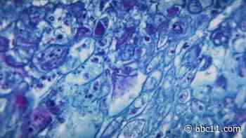 'It's been a journey': Man with first Monkeypox case in Durham County shares story with ABC 11 - WTVD-TV