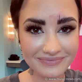 Demi Lovato needs stitches after 'hitting head on a crystal'
