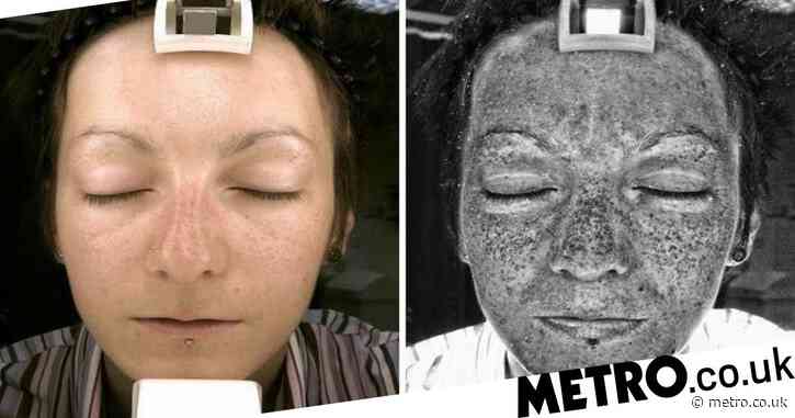 Pictures that will make you think twice about going into the sun without protection