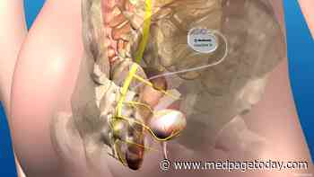 Sacral Neuromodulation Promising in Neurogenic Lower Urinary Dysfunction