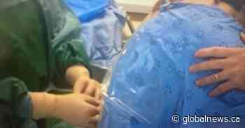 Alberta Health Services taking action over shortage of epidural catheters