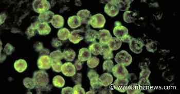 Patient from Missouri dies after contracting brain-eating amoeba while swimming in now-closed Iowa lake