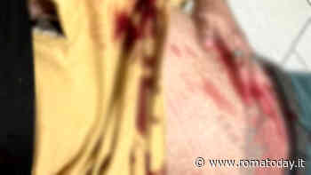 "So stato accoltellato, se moro ve voglio bene"