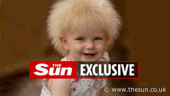 My baby daughter looks like Boris Johnson because she has a rare condition which means her hair can’t be c... - The Sun