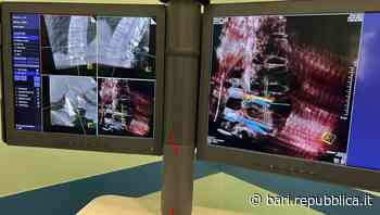 Un pc per aiutare a correggere la scoliosi: al Policlinico di Bari il primo intervento computer-assistito su … - La Repubblica