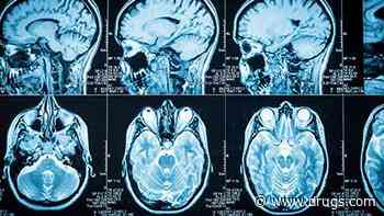 Special Brain Scans May Diagnose Early Parkinson's