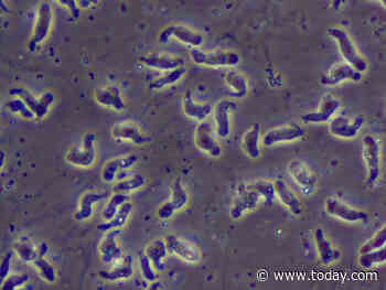 Swimmer dies after contracting 'brain-eating amoeba' in lake in Iowa
