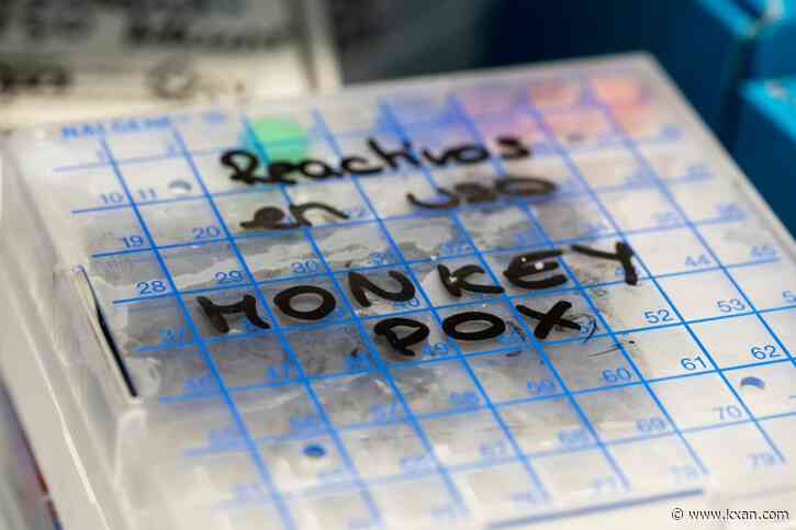 Austin-based lab to handle monkeypox tests from across the U.S.