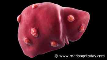 What's the Safest Path to Neoadjuvant Therapy in Liver Cancer?