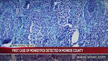 3 cases of monkeypox detected in Monroe County